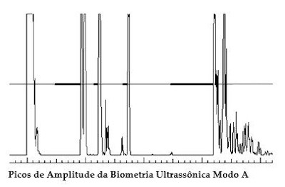 Biometria ultrassnica.